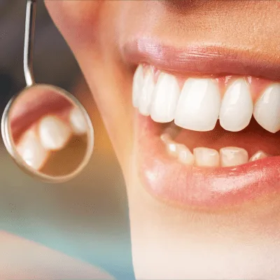¿Qué médico trata la sensibilidad dental en CDMX?